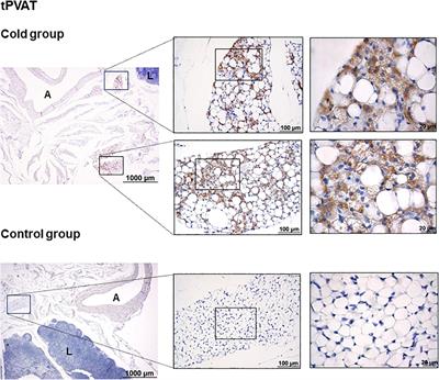 Cold Induced Depot-Specific Browning in Ferret Aortic Perivascular Adipose Tissue